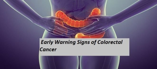 Early Warning Signs Of Colorectal Cancer The Cure International
